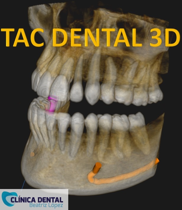 TAC DENTAL 3D Clínica Dental Beatriz López